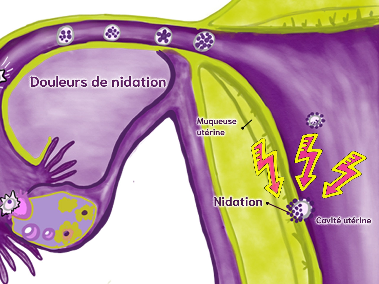 La douleur de nidation et les symptômes en début de grossesse ...